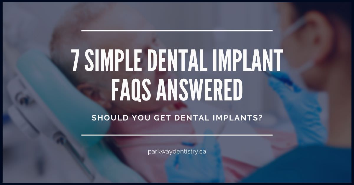 dental-implant-faq